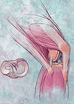 knee arthroscopy